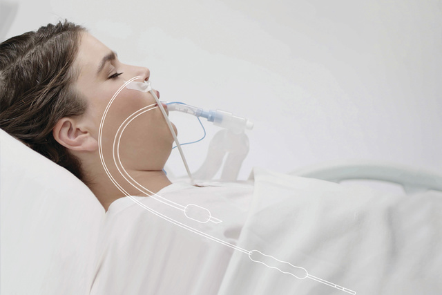 Mechanical ventilation intubated sedated patient with transpulmonary pressure catheter
