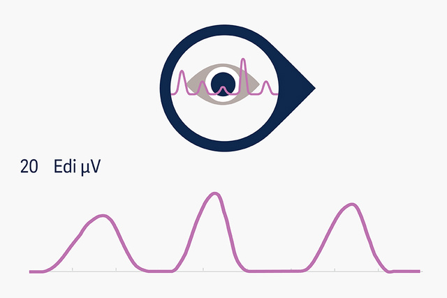 Graphic illustration depicting the patients Edi signal, the vital sign of respiration