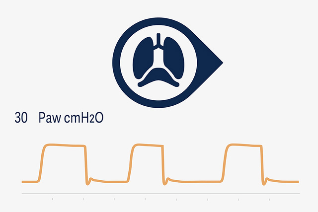 Graphic illustration depicting the NPS Neural Pressure Support and NIV NAVA ventilator wave form