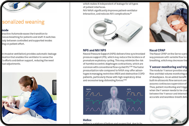 Tablet computer displaying a slide from the Servo-u functionalities flyer showing an Edi hardware module and NPS x-ray torso graphic illustration