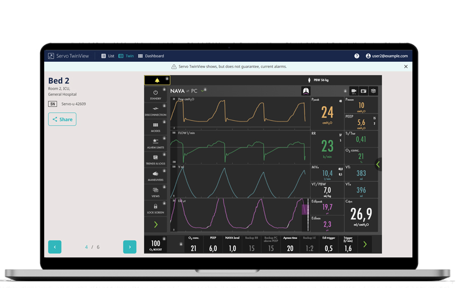 Mobile phone screens displaying Servo ventilator TwinView remote virtual twin app 