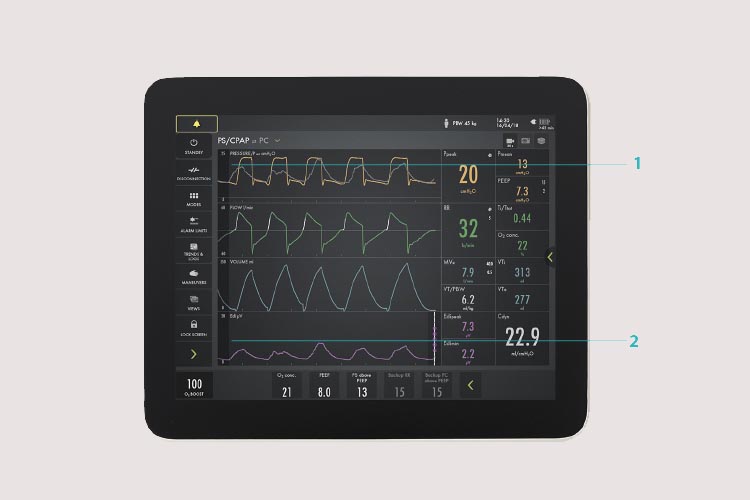 Edi signal monitoring