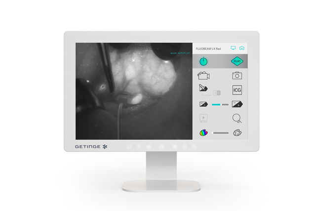 Fluobeam-LX-red-autofluorescence