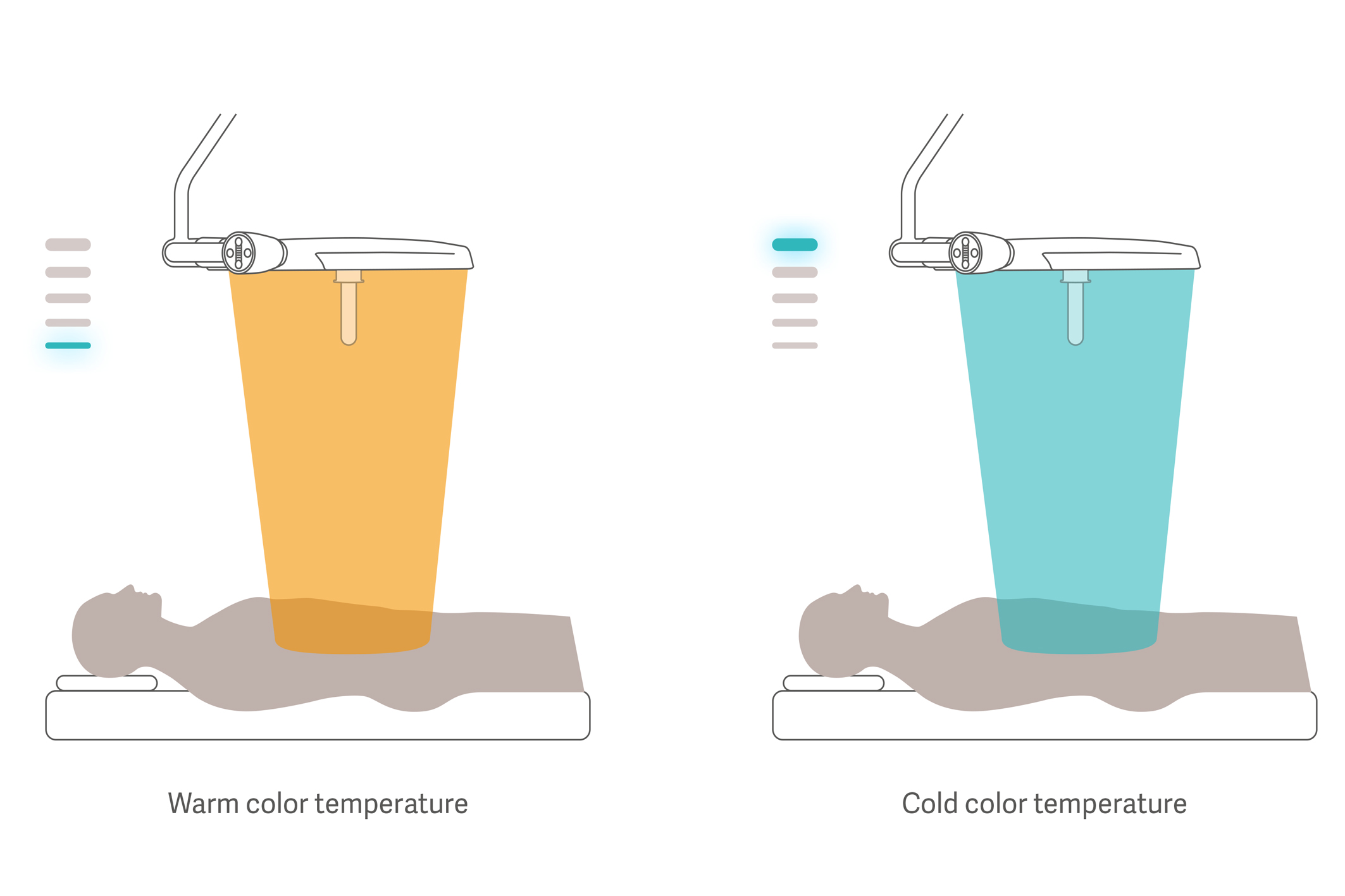 Drawing of  Maquet Ezea surgical light adjustable color temperatures