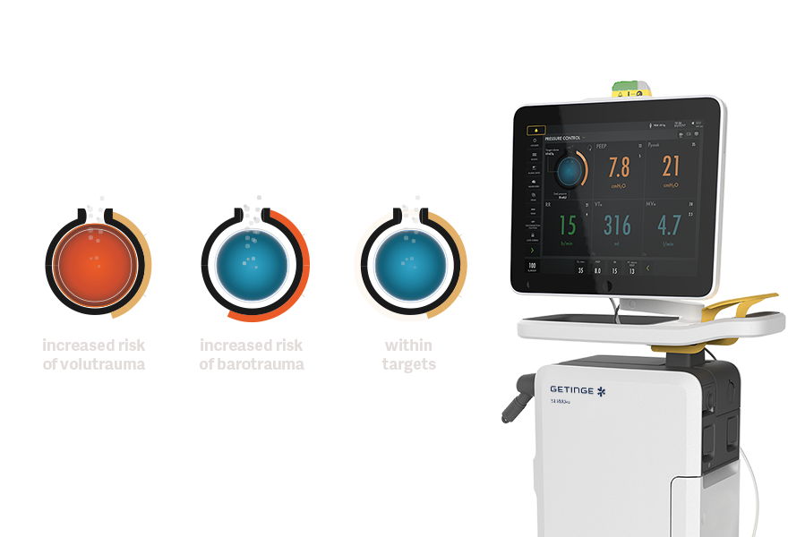 Getinge Servou® MR the MR Conditional ventilator designed with safety in mind